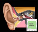 Illustratie van Power Receiver in het oor met bijbehorend audiogram.